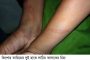 বাগেরহাটে কওমী মাদ্রাসা শিক্ষকের পিটুনিতে আহত ছাত্র হাসপাতালে