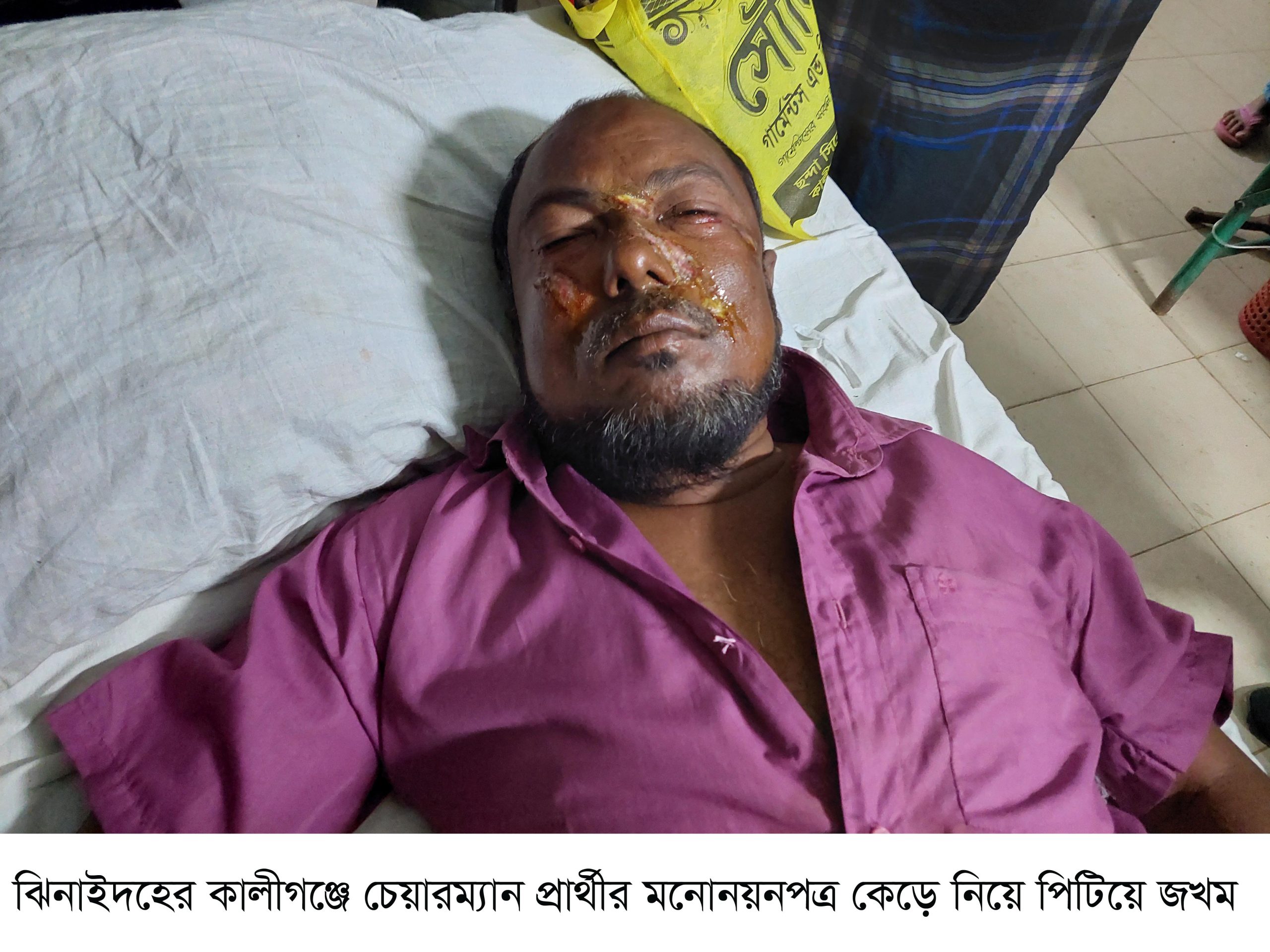 Kaligonj chairman candidate assault Photo