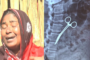 রোগীর পেটে কাঁচি রেখে সেলাই, ক্লিনিক মালিক কারাগারে