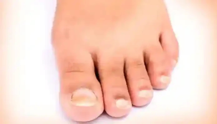 53891_nail