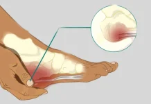 গোড়ালির হাড় বৃদ্ধির কারণ এবং করণীয়