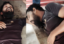 নগরীতে দুর্বৃত্তের গুলিতে যুবক আহত