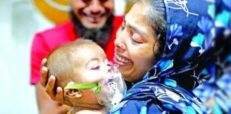 হাম ও উপসর্গে ১০ শিশুর মৃত্যু, ৫ জনই ঢাকা বিভাগের