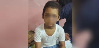শিক্ষকের পিটুনি: মস্তিষ্কে জমাট বেঁধেছে রক্ত, ঘুমের মধ্যে কেঁপে কেঁপে উঠছে শিশুটি