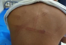 সাতক্ষীরায় জামায়াত নেতাকে পিটিয়ে আহত করার অভিযোগ