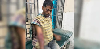 বিদ্যুতের খুঁটিতে বেঁধে পাইপ দিয়ে পিটুনি, এসিডে ঝলসে দিল যুবককে দু’হাত