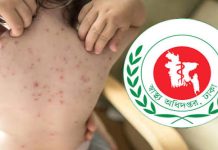 হাম ও উপসর্গে আরও ৭ শিশুর মৃত্যু
