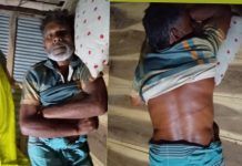ডুমুরিয়ায় সুদের টাকা ফেরত চাওয়াকে কেন্দ্র করে ভ্যানচালকের ওপর হামলা